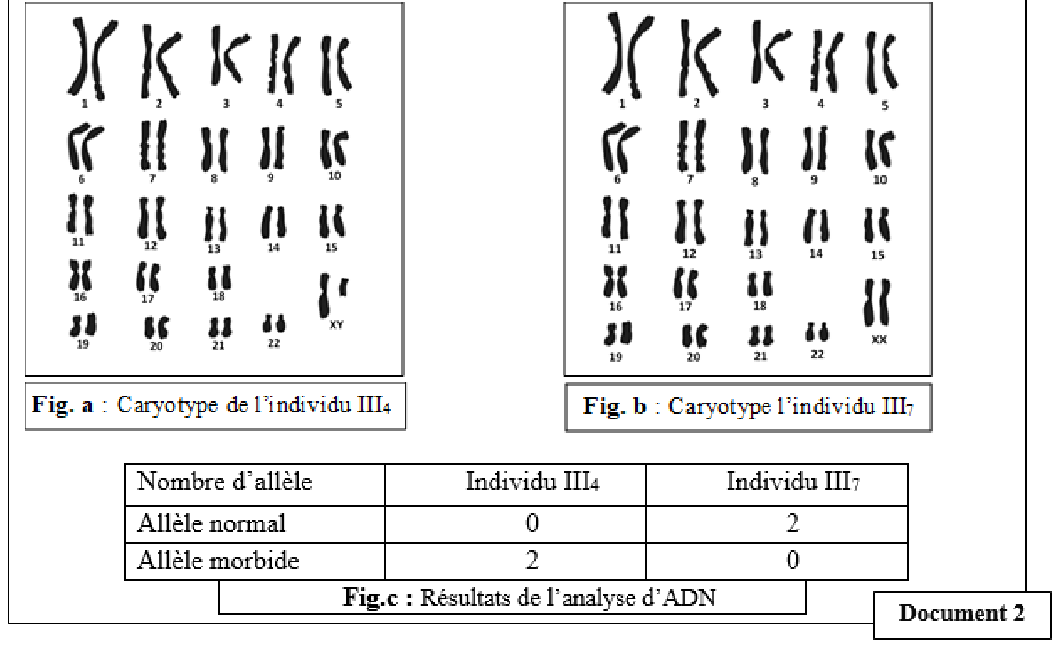Document 2 : Caryotypes des individus III4 et III7 et résultats de l'analyse d'ADN